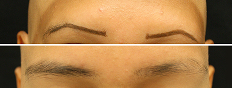 eyebrow-before-and-after